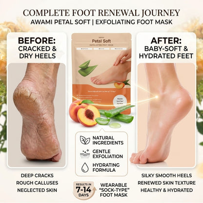 Luvia Foot Peel Mask – 2 Pairs Exfoliating Foot Peeling Mask for Dry, Cracked Feet | Aloe Vera & Peach Foot Mask Socks for Baby Soft Feet